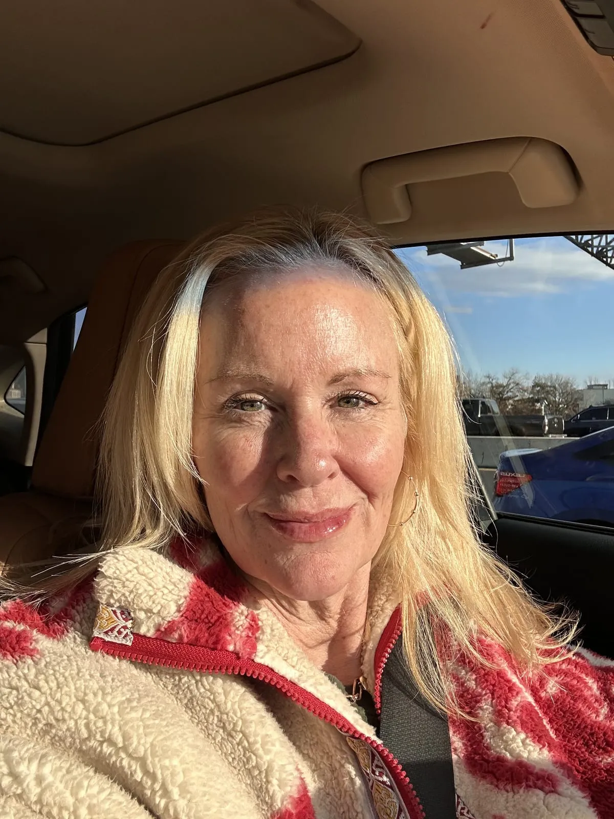 Client after a dermal filler treatment